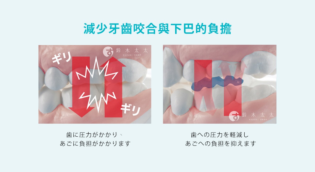 減少牙齒咬合與下巴的負擔
