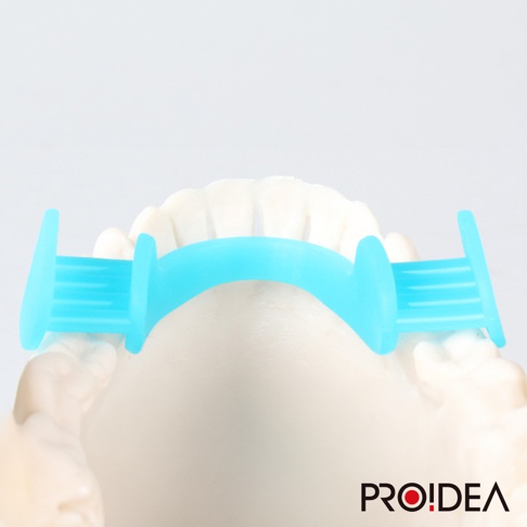 淺藍色矽膠製成的睡眠防磨牙靜音牙套，呈 C 型弧狀，兩端有條狀把手，放置於牙齒模型上，用於撐開口腔。