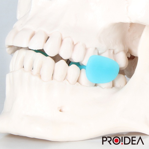 模型牙齒上放置著一個淺藍色的睡眠防磨牙靜音牙套，牙套材質看起來是矽膠或類似軟性塑料。